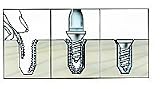 Stripped Screw Hole Repair Kit (8 pcs. 3/4'' x 2'' )