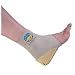 Tuli's Cheetah Heel Protector, Medium (80-100lbs)