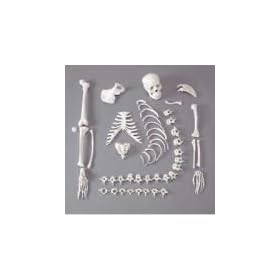 One-Half Disarticulated Budget Skeleton with Skull Model#AW-CHA4/1
