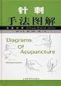 Diagrams of Acupuncture Manipulations