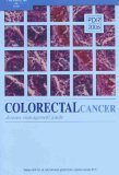Colorectal-Cancer