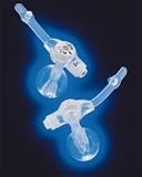 Ballard Mic Key Skin Level Gastrostomy Tube Kit 16 French 2.0Cm Stoma Length - Model 0120-16-2.0