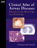 Clinical Atlas of Airway Disease: Bronchoscopy, Radiology and Pathology