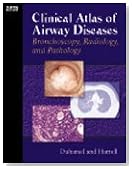 Clinical Atlas of Airway Disease: Bronchoscopy, Radiology and Pathology