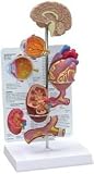 Hypertension Model - mini brain, eye, heart, kidney and artery models (patient education card included)