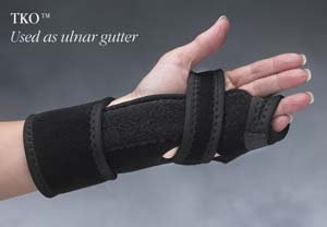 TKO - The Knuckle Orthosis Right