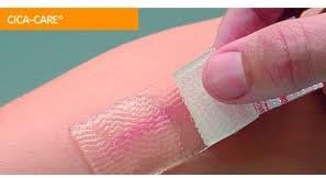 Cica Care Gel Sheeting size 12cm x 3cm (1 sheet) , medically proven to be up to 90% effective in the improvement of red, dark or raised scars. It has been used by the medical profession to treat over one million people worldwide, reusable