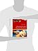 Ultrasound Guided Regional Anesthesia