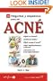 100 Preguntas y respuestas acerca del Acn� (Spanish Edition)