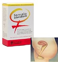 FC Female Condom - Quantity - 10 Pack