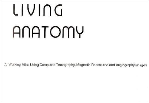 Computed-Tomography
