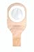 Search : ConvaTec SQB405406 ESTEEM synergy Straight Drainable Pouch