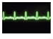 Electrocardiogram Trace Photographic Poster Print by David M. Dennis, 16x12