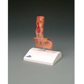 Disease of the Esophagus Model by Anatomical