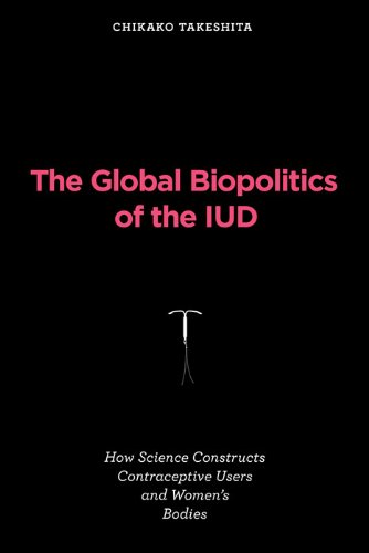 iud