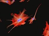 Mammalian Nerve Cells Dendrite Sensory Synapse Photographic Poster Print, 40x30