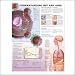Understanding HIV & AIDS Anatomical Chart 20