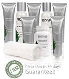Exposed Acne Treatment – Ultimate Kit
