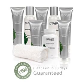 Exposed Acne Treatment - Ultimate Kit