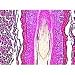 Skin with hair follicles sec.
