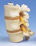 3 Lumbar Vertebrae Model, flexibly mounted