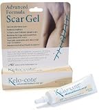 Kelo-Cote- Scar Recovery .2oz/ 6g.