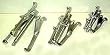3 Pcs Gear Puller Set