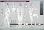 Acupuncture Chart - Points & Meridians of Acupuncture