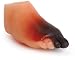 3B Scientific W43107S Biolike Diabetic Foot Model Set