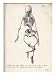 Skeleton of an Adult Patient Afflicted with Rickets Art Giclee Poster Print by Langlu...