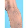 V.V. Calendula Cream. Natural Help For Visible Veins. 120ml