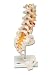 Flexible Lumbar Vertebral Column with Herniated Disc A76/5