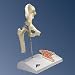 Mini Hip Joint Model with cross-section