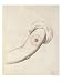 Cowpox Pustule on an Arm, 1800 Art Giclee Poster Print by William Skelton, 18x24