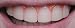Cartoon Teeth