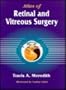 Atlas Of Retinal And Vitreous Surgery, 1e