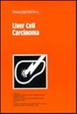 Liver cell carcinoma