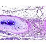 Epithelium ciliated columnar sec.