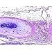 Epithelium ciliated columnar sec.