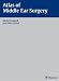 Search : Atlas of Middle Ear Surgery