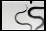 Classic Hookworm Disease Film DVD: 1922 Hook Worm & Intestinal Parasite Infection Symptoms & Treatment Film