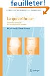 La gonarthrose : Traitement chirurgic...