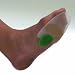 PerFeet 100% Silicone Forefoot Metatarsal Inserts