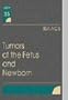 Tumors of the Fetus and Newborn