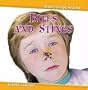 Bites and Stings (Head-To-Toe Health)