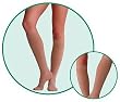Juzo 3512N Varin 30-40 Compression Closed Toe Thigh High Socks Neuropathic