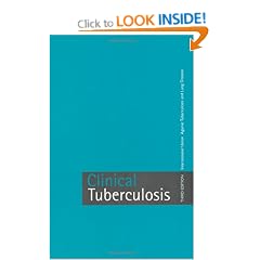 Clinical Tuberculosis