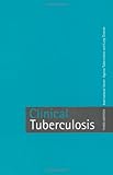 Crofton's clinical tuberculosis