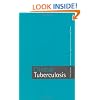 Clinical Tuberculosis
