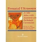 Prenatal Ultrasound: A Color Atlas With Anatomic and Pathologic Correlation by Beverly A. Spirt, Lawrence P. Gordon, and Michael Oliphant
